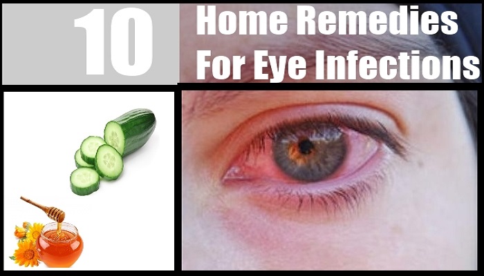 Easy And Effective Home Remedies For Eye Infection Netmarkers 6913
